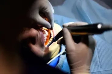 Maroc : L'Ordre des médecins dentistes pointe l'ampleur des activités illégales